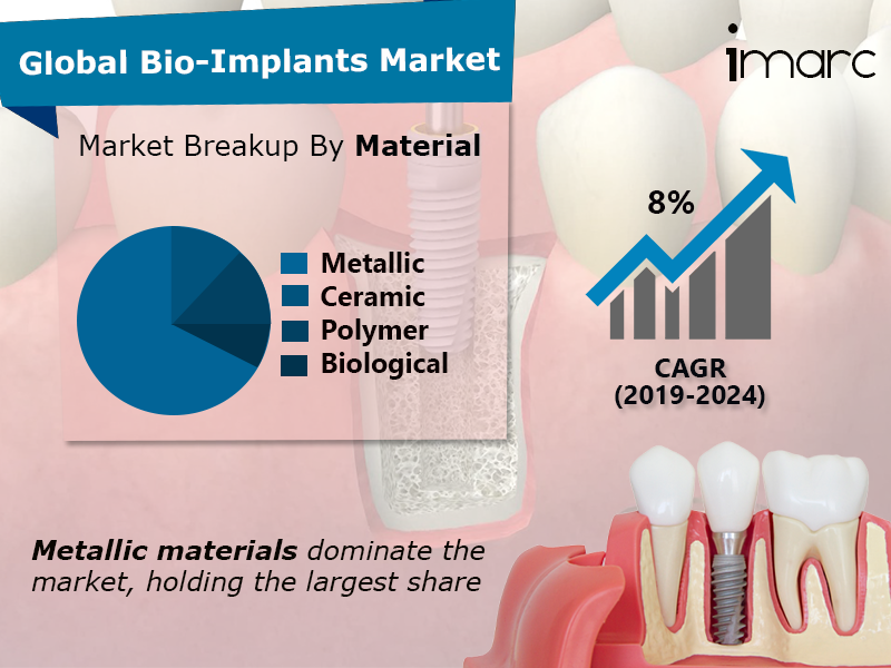 全球Bio-Implants市场